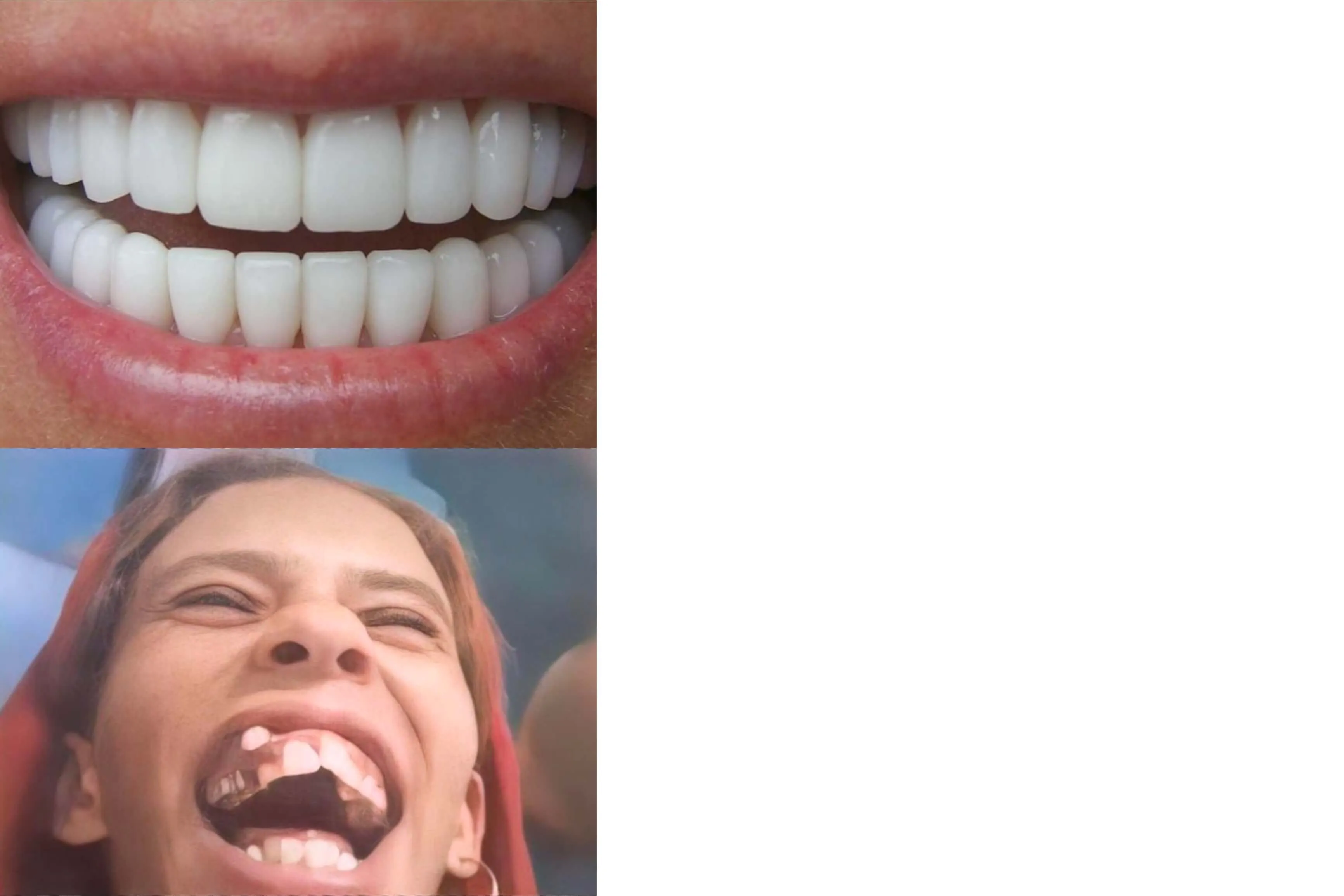 Plantilla de Dientes perfectos | Dientes imperfectos