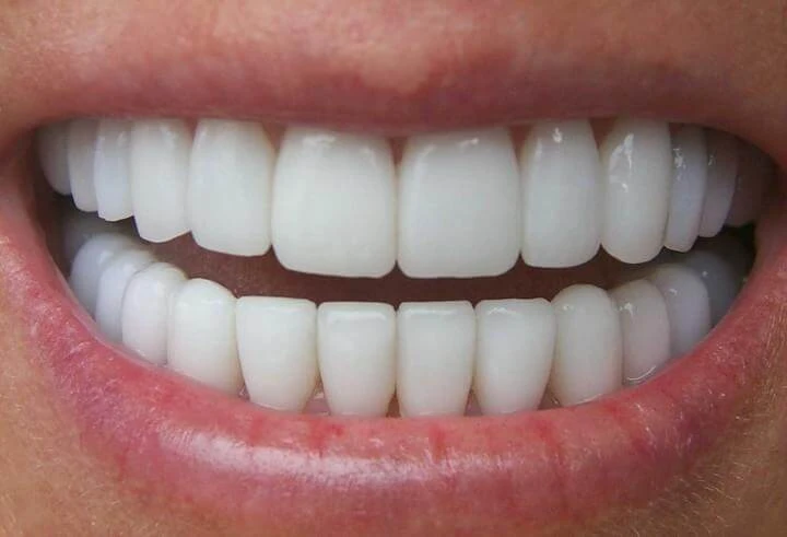 Plantilla de Dientes perfectos | Dientes imperfectos