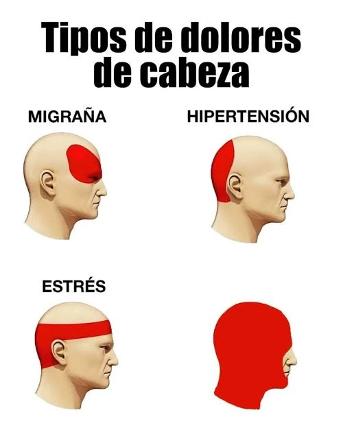 Plantilla de Tipos de dolores de cabeza